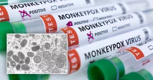 How does monkeypox spread?